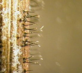 Périthèces - Vue à la loupe binoculaire - cliquez pour agrandir